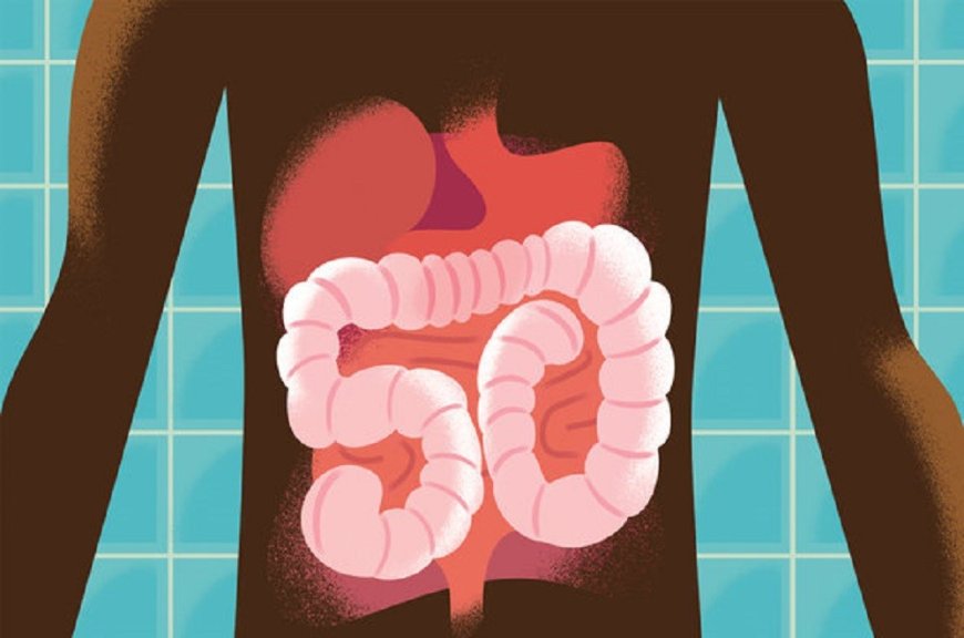 Colon Checkup and Colorectal Cancer