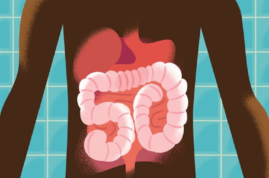 Colon Checkup and Colorectal Cancer