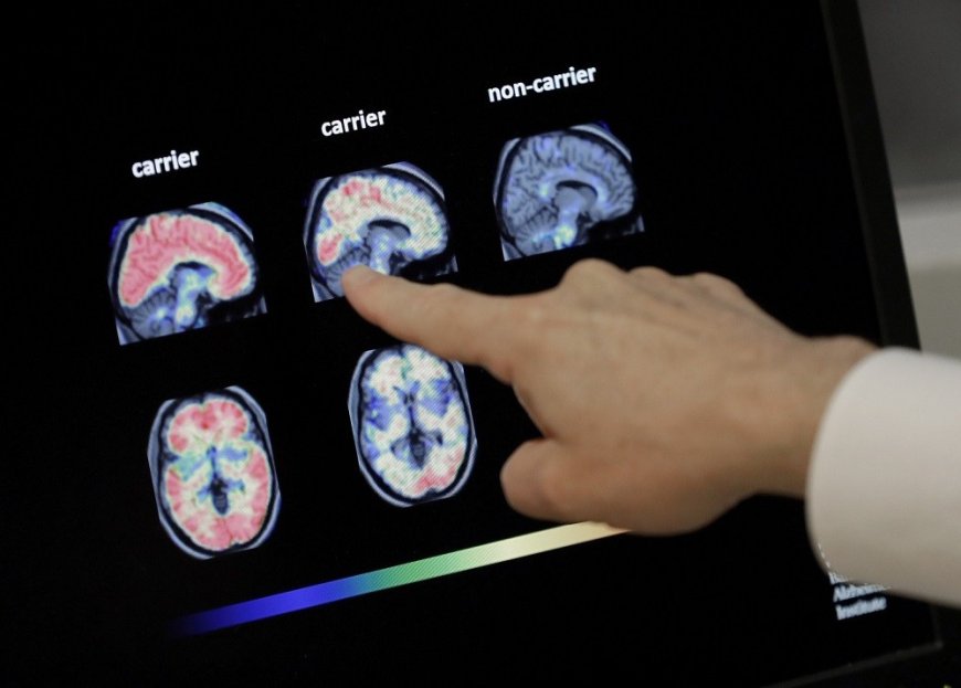 Are brain scans even accurate?