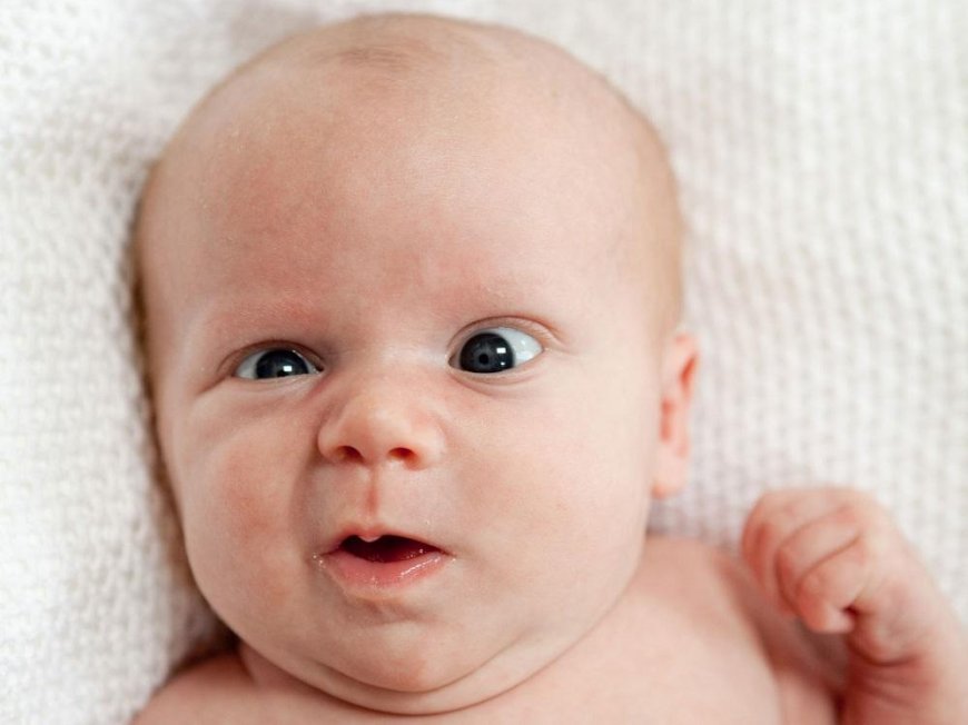 Strabismus baby: causes, diagnosis and treatment