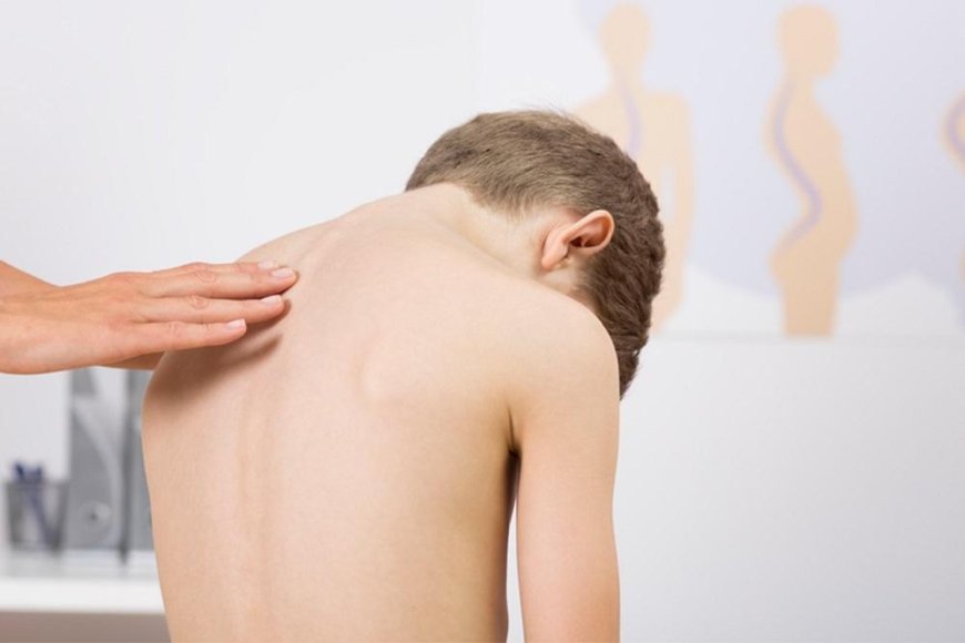 Treatment of scoliosis in children - learn more about it!