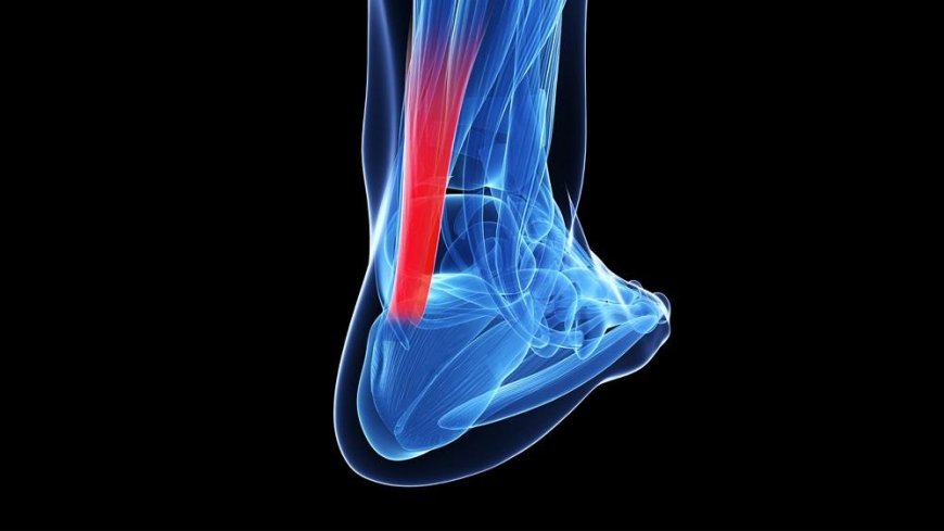 Tendons and injuries - what causes them most?